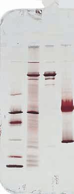 Purification of monoclonal mouse IgG 1 from cell culture supernatant Mouse IgG 1 was purified from 150 ml cell culture supernatant on HiTrap rprotein A FF 5 ml column.
