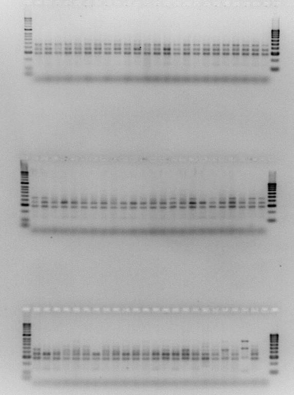 The negative control that was used in amplifying blaspm gene is V. cholerae MO10. Negative Controls Reaction mix only Figure 9 (on the left). Agarose gel electrophoresis (2.