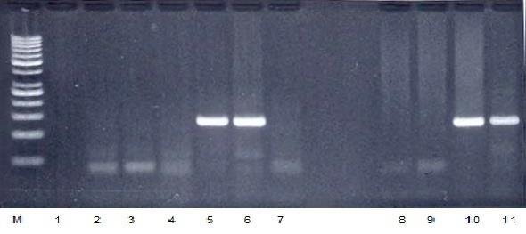 Figure 5: Agarose gel photograph of mycobacterium PCR products. A positive result is seen on lanes 5, 6 and 10. M= Molecular weight ladder at 50 bp gradations. 11= Positive control. D.
