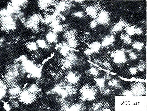 COMPONENTS OF THE MICROSTRUCTURE OF CH