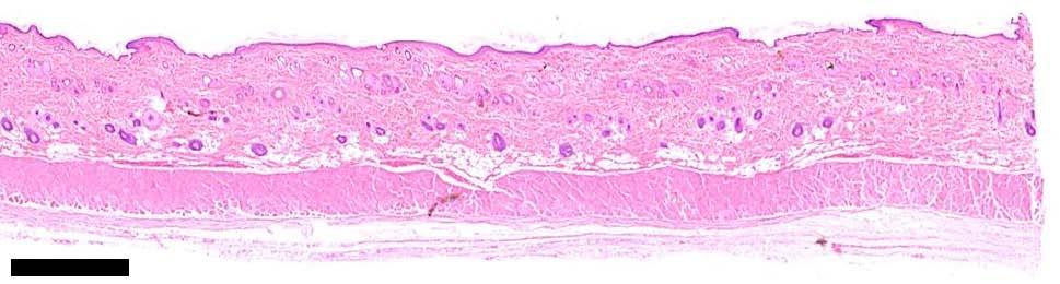 epidermis dermis 1 mm panniculus
