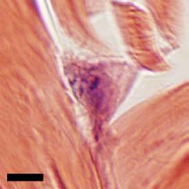 dermis 5 µm cf = collagen fibril fb