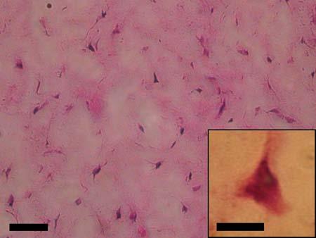 mesenchymal stem 5 mm