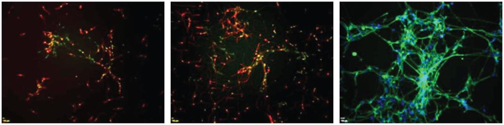 Phase-contrast image of derived NSCs (left), phenotype marker expression of derived NSCs (middle; red = Sox1, green = Nestin), and NSCs differentiated into neurons for 2 weeks, whose neurites were