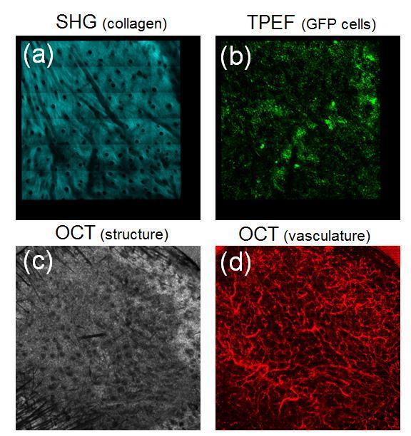 Figure 7.5. Multimodal imaging of a skin graft in a GFP BM-transplanted mouse. (a) Wide-area SHG mosaic of collagen. (b) Wide-area TPEF mosaic of the GFP expressing BM-derived cells.