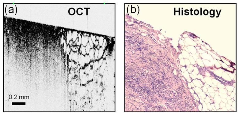compare an OCT image of a breast tissue sample and the corresponding hematoxylin and eosin (H&E) histology slice.