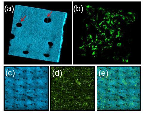Figure 8.1. In vivo MPM imaging of GFP-BM-transplanted mouse skin. High-resolution renderings of (a) SHG and (b) TPEF image volumes.