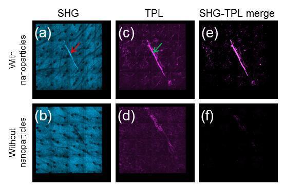 Figure 8.3. Imaging zinc oxide (ZnO) nanoparticles in the presence of skin autofluorescence based on SHG and TPL.