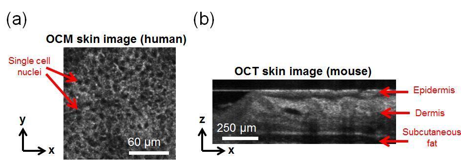 Figure 2.4 (a) OCM and (b) OCT images of skin. OCM provides enface images with cellularlevel resolution while OCT provides cross-sectional images over a large depth range.