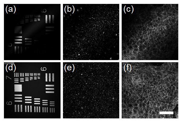 Figure 4.4. OCM images of (a, d) a standard USAF resolution chart, (b, e) 50 nm Fe 2 O 3 particles embedded in silicon gel and (c, f) in vivo human skin epidermis.