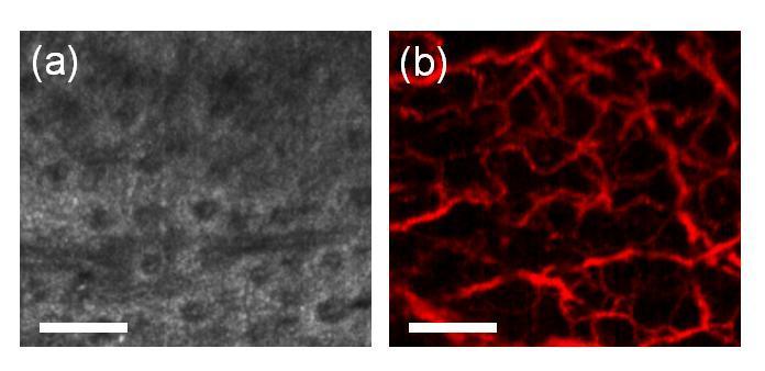 Figure 4.7. An enface (a) OCT section of in vivo mouse skin and (b) the corresponding projection of the OCT phase variance showing the vascular network. Scale bar is 250 µm.