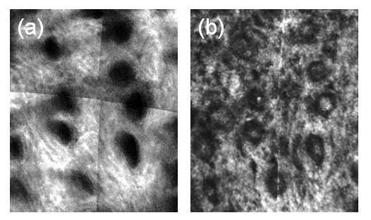 Figure 5.2 Enface (a) SHG and (B) OCM images of the dermis of mouse skin. Both modalities are capable of visualizing hair follicles in skin.