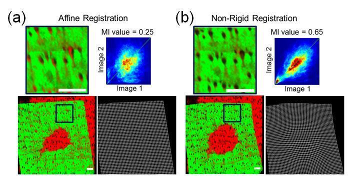 Figure 5.5 Evaluation of the (a) affine and (b) non-rigid registration of the images from Fig. 5.4.