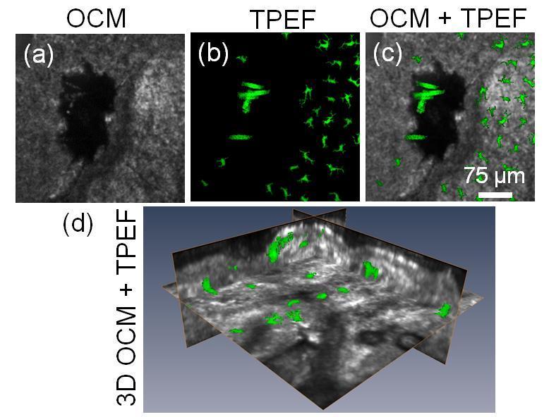 Figure 6.7 (a) OCM and (b) TPEF images of skin from a mouse that had received a BM transplant from a GFP donor.