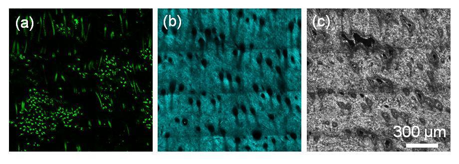 Figure 6.8 (a) TPEF, (b) SHG and (c) OCM mosaics from GFP BM-transplanted mouse skin. images were acquired over a wide field of view by using the motorized stage to generate mosaics.