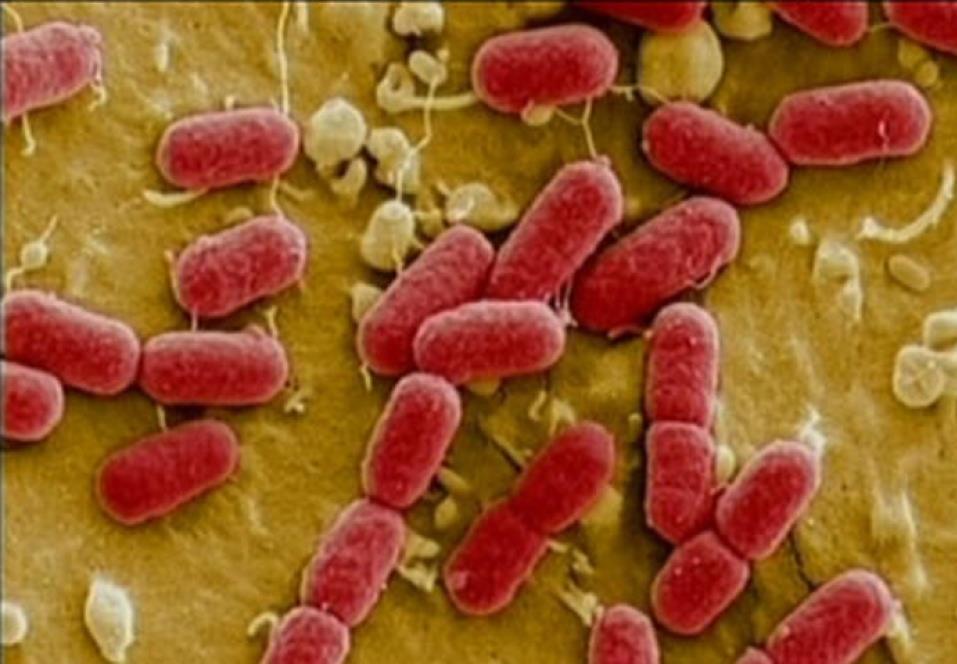 E. coli O157 (STEC/VTEC) Illness onset 3 to 9 days (mean 4 days) following ingestion of the bacteria.