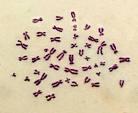 5. Chromosomes: Bundles of DNA that are made up of genes that carry information for the entire