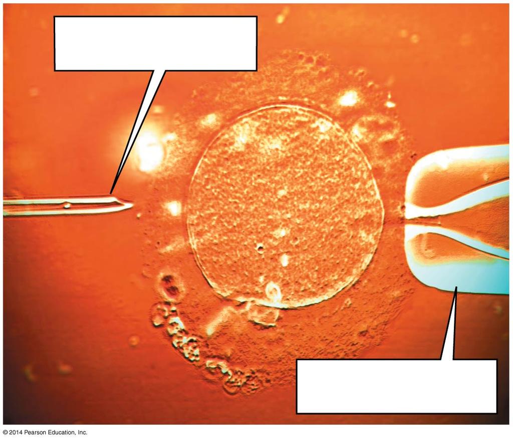 Figure 13-11 Transfecting a fertilized egg by injecting foreign DNA Sharp,
