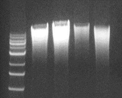 M is a 1 kb DNA size marker (Zymo Research). M w/o Zymo-Spin IV-HRC w/ Zymo-Spin IV-HRC 0 0.1 0.01 0.001 0 0.1 0.01 0.001 PCR of diluted DNA (0 to 0.