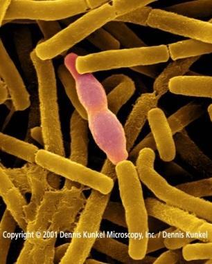 Agricultural Biotechnology Insect resistance Bacillus thuringiensis a bacterium that produces toxins (Cry proteins)