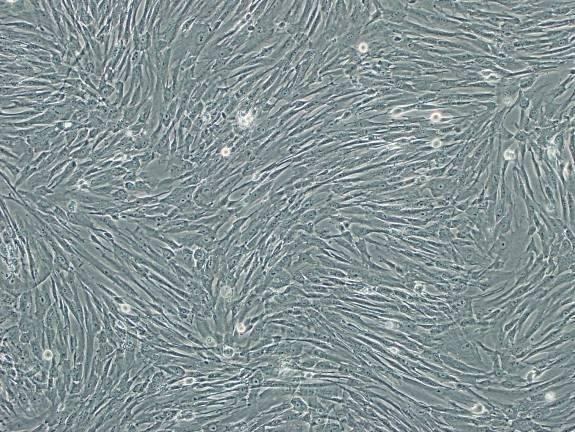differentiate into a variety of cell types including osteocytes, adipocytes, and chondrocytes.