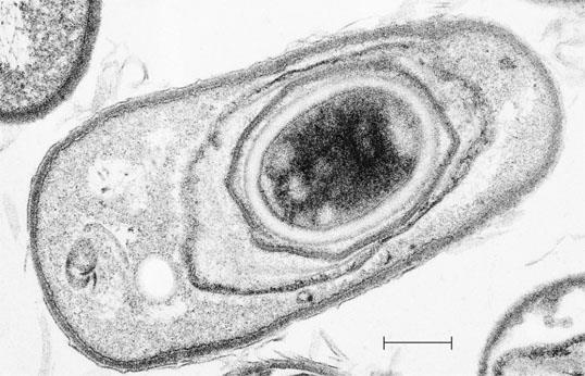 Many prokaryotes form endospores Which can remain viable