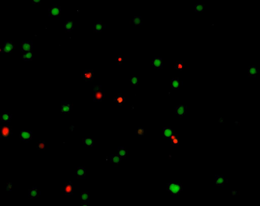 7. Sample Data Live and Dead assay by fluorescent microscopy: A B Figure 1. Jurkat cells stained with the live and dead assay kit.