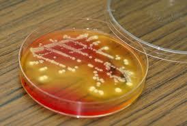 8c Bacterial conditions for Growth Bacteria need the following conditions for growth: Energy in the form of food (in humans this is their cells or food they have eaten) Moisture enough water for