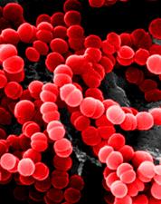 Example of a Bacteria species Streptococcus pyogenes These spherical bacteria are common inhabitants of the throat.