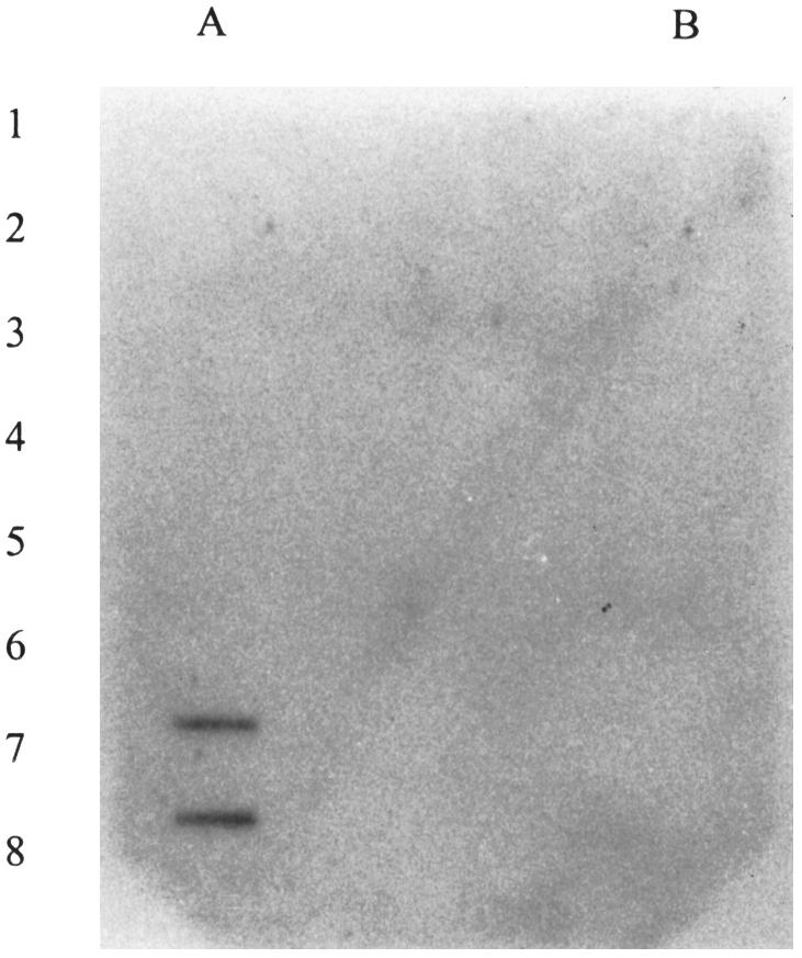 20 NEMATROPICA Vol. 31, No. 1, 2001 different Meloidogyne isolates: M. arenaria race 2-NC1, M. hapla-wi, M. incognita race 4-NC, and M. javanica-nc, were tested at 500 ng DNA per slot.