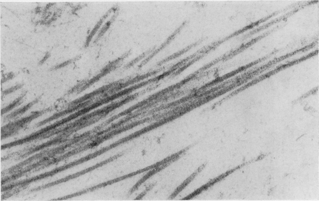 480 Peter G. Toner, Katharine E. Carr, Anne Ferguson, and Colin Mackay Fig. 14 The repeating periodicity of collagen is seen in these fibres from a similar specimen to that shown in Figure 13.