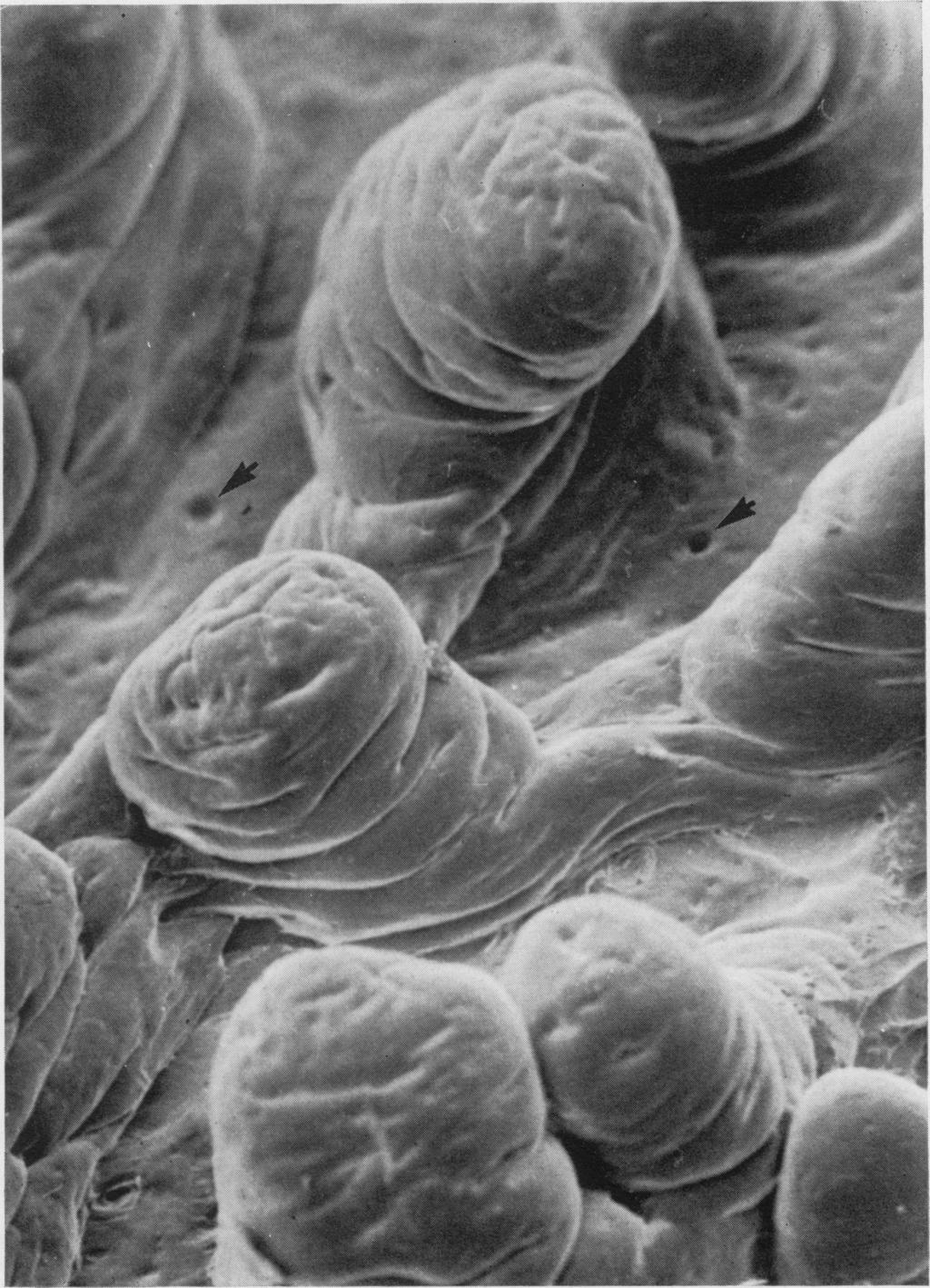 473 Scanning and transmission electron microscopic studies of human intestinal mucosa Gut: first published as 10.1136/gut.11.6.471 on 1 June 1970. Downloaded from http://gut.bmj.com/ Fig.