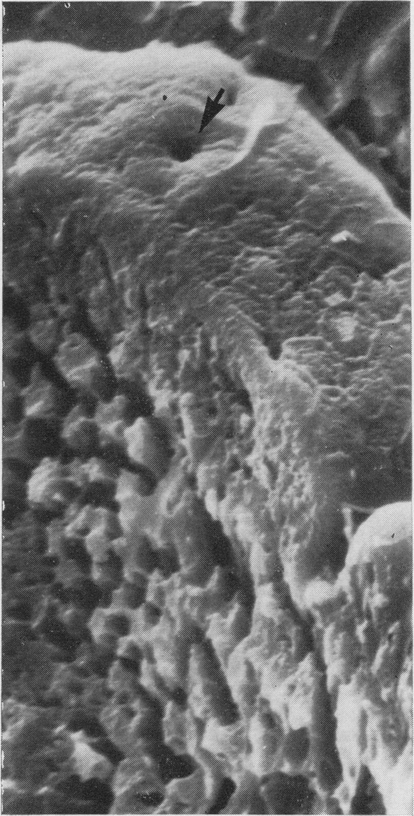 1 and 2). At high magnification (Marsh et al, 1968; Toner and Carr, 1969) hexagonal patterns formed by the close-packed apical surfaces of the columnar cells may be seen.