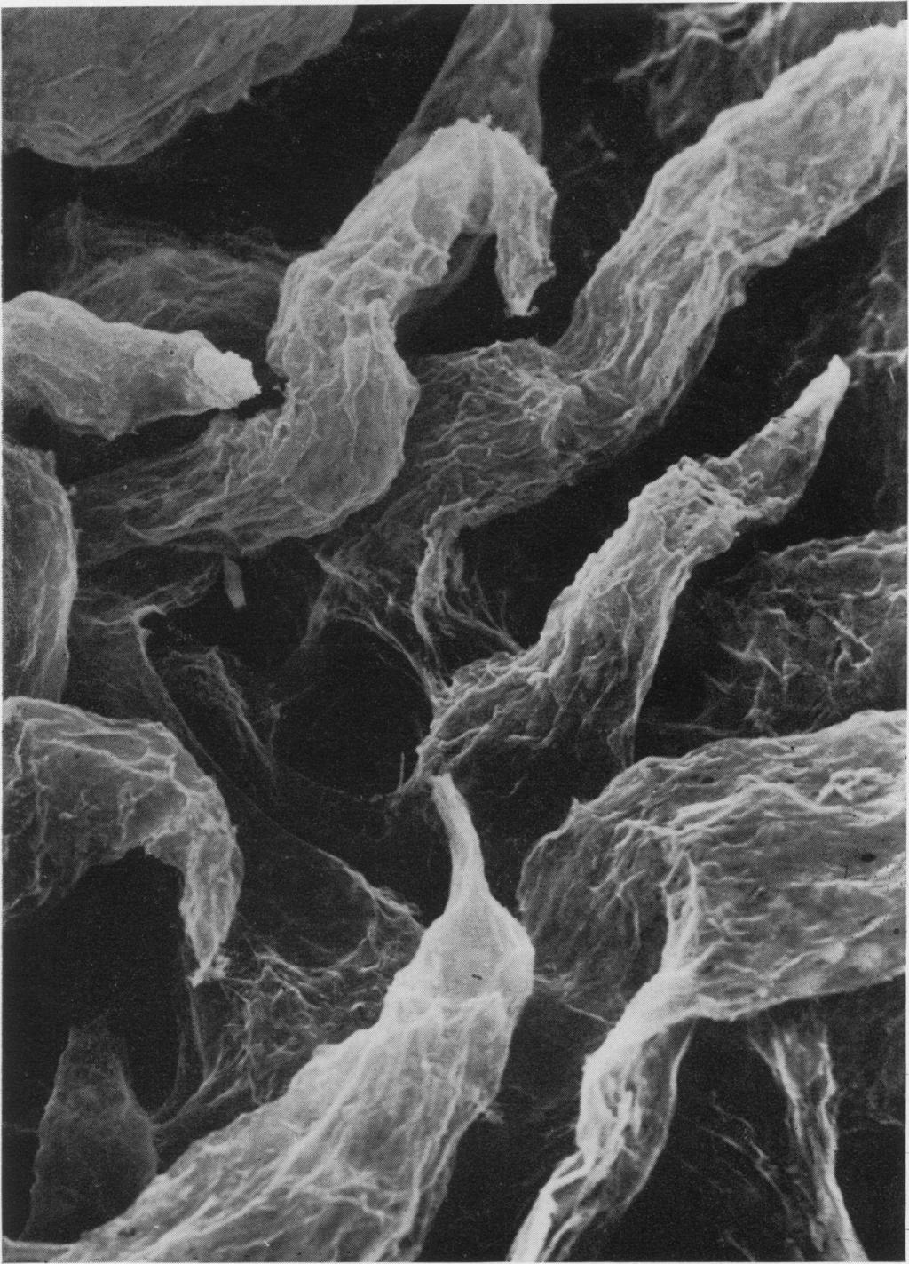 477 Scanning and transmission electron microscopic studies of human intestinal mucosa Gut: first published as 10.1136/gut.11.6.471 on 1 June 1970. Downloaded from http://gut.bmj.com/ Fig.