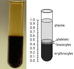 centrifuged sample --> plasma/serum anticoagulant inside tube ---> plasma (clotting