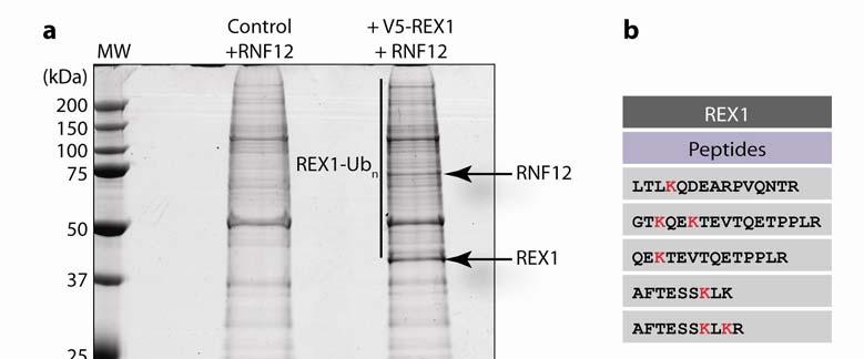 RESEARCH Supplementary Figure 5 REX1 is polyubiquitinated by RNF12.