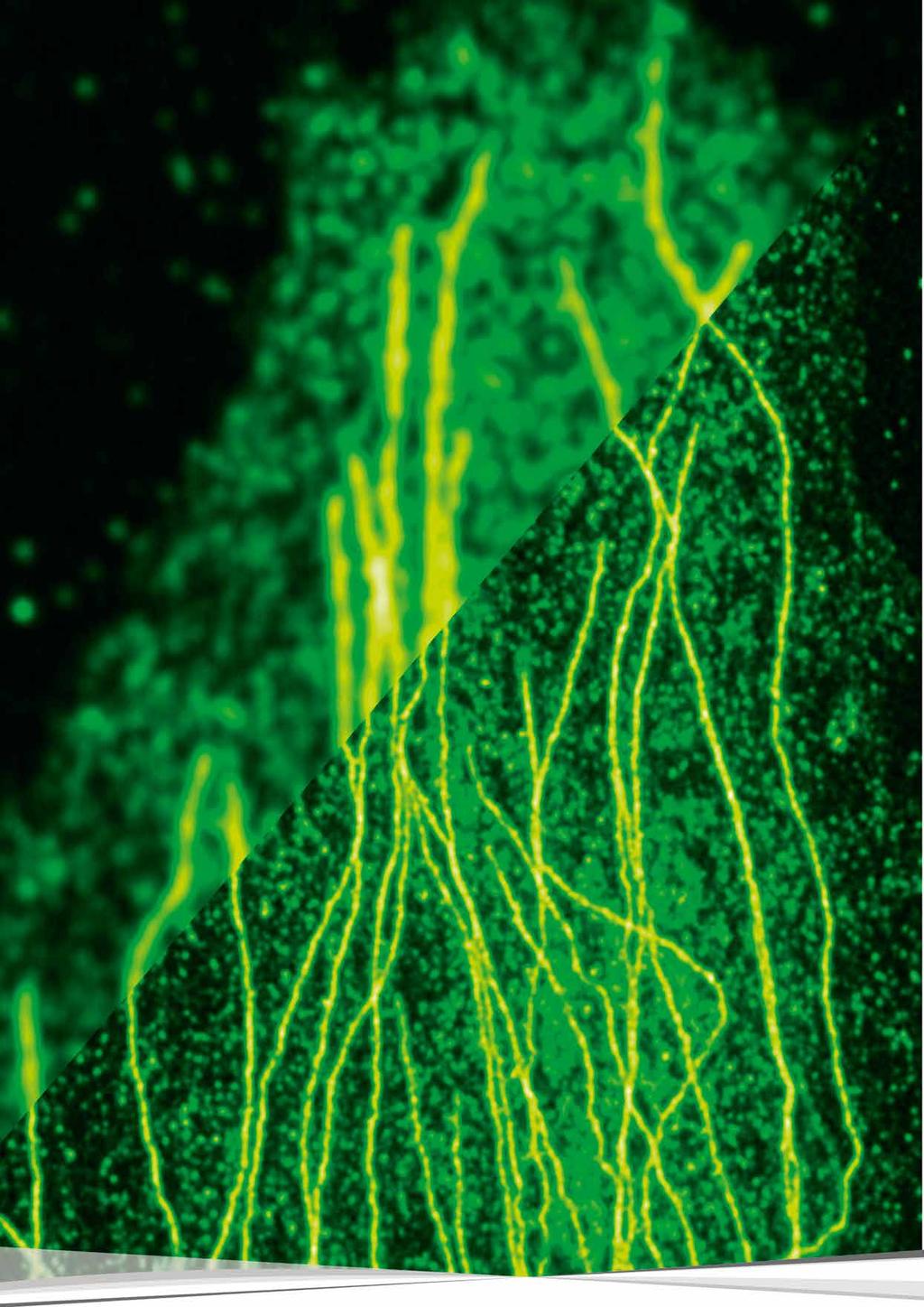 STED beyond imaging Higher resolution, more information STED significantly enhances the resolution of confocal fluorescence microscopy.