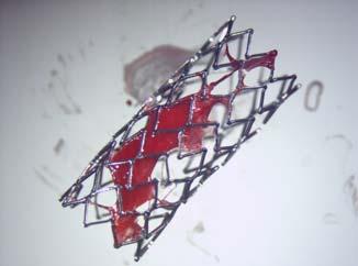 Biodegradable Stent Delivery Systems