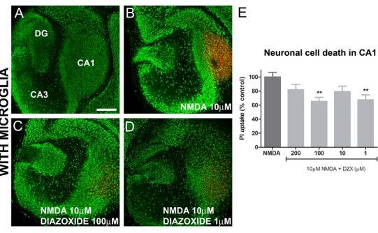 Mechanism of Action (I) Neuroprotective causes neuroprotection in organotypic cultures NMDA 10 µm NMDA 10 µm Dose 3 NMDA 10 µm Dose 1 D4 D3 D2 D1 NMDA + PI (cell