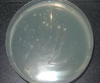 Figure 3: Four dust sample from different place Figure 6-A: The bacteria and mold growth After