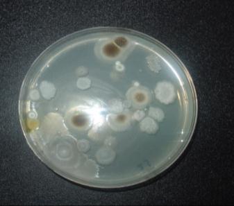 Figure 6-B: The bacteria and mold growth After 48 hours Figure 4: Add sample into 9ml sterile