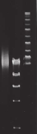 1 2 M Figure 1 2% Agarose gel/1 TAE Lane Sample 1 200 μl of a whole blood sample 2 Negative control M 100 bp Ladder (Invitrogen) As a result of this PCR, the band of the amplification product from 0.