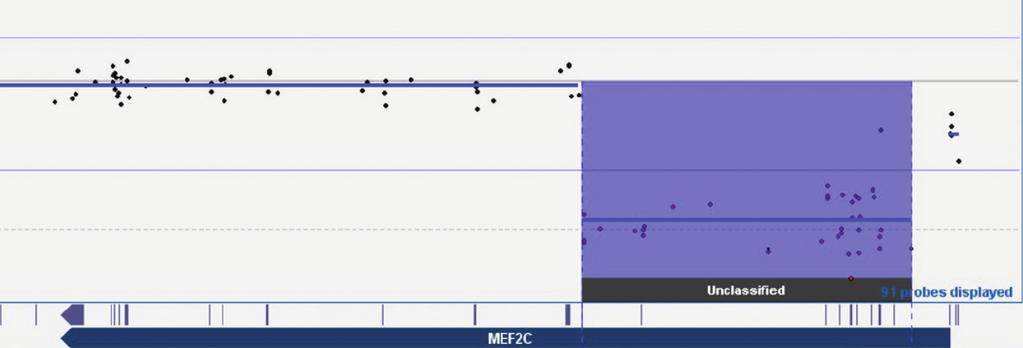 Figure 3: CytoSure Constitutional v3 array probes across the MEF2C gene displayed using CytoSure Interpret Software.