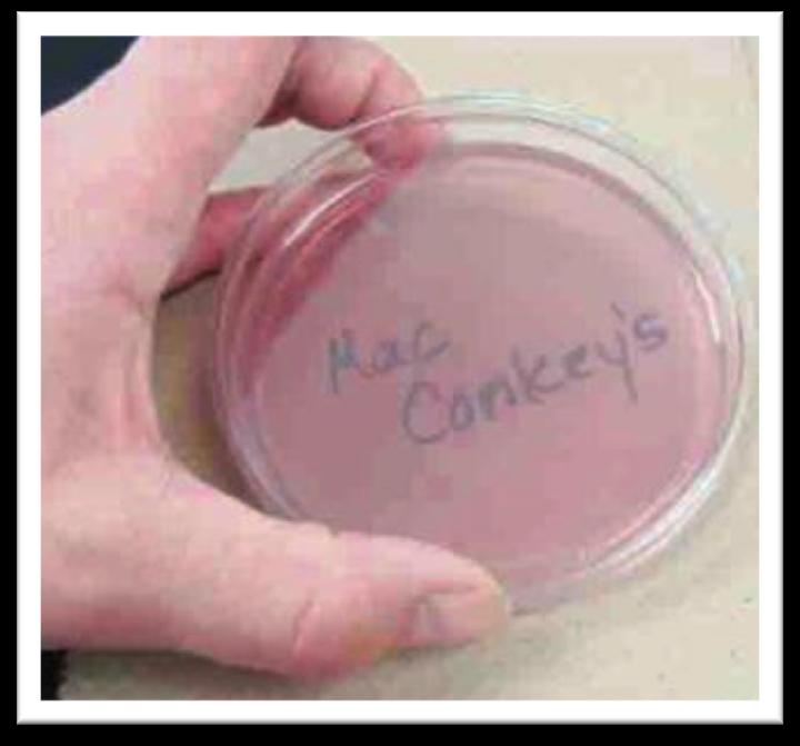 MacConkey's (MAC) MacConkey s media is both selective & differential. 1. Selective because it only grows Gram-negative bacteria. Inhibits the growth of Gram-positive bacteria. 2.