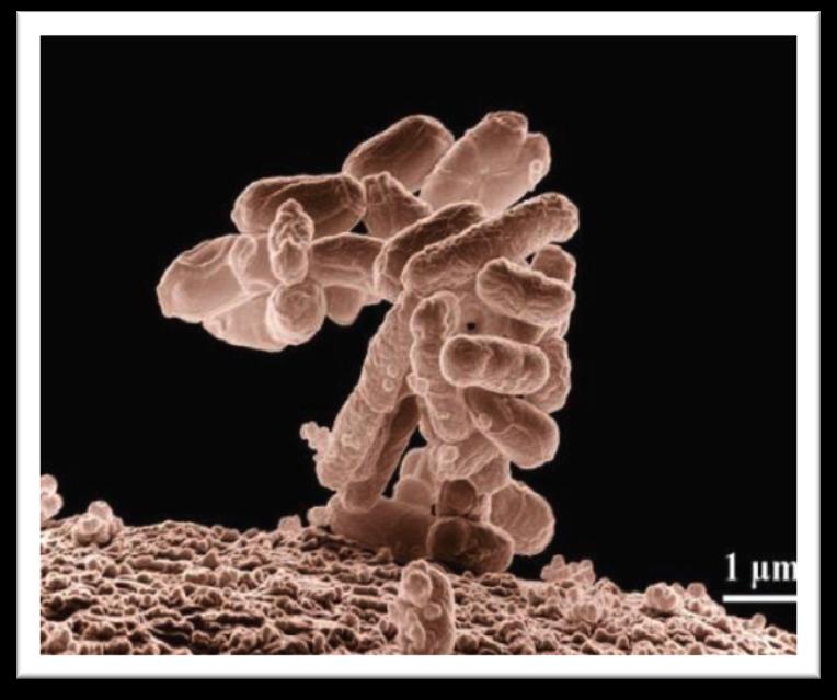 Meet the Microbe: Escherichia coli GRAM-NEGATIVE Facultative anaerobe, lactose fermenter ( ) bacillus-shaped Some strains of E.