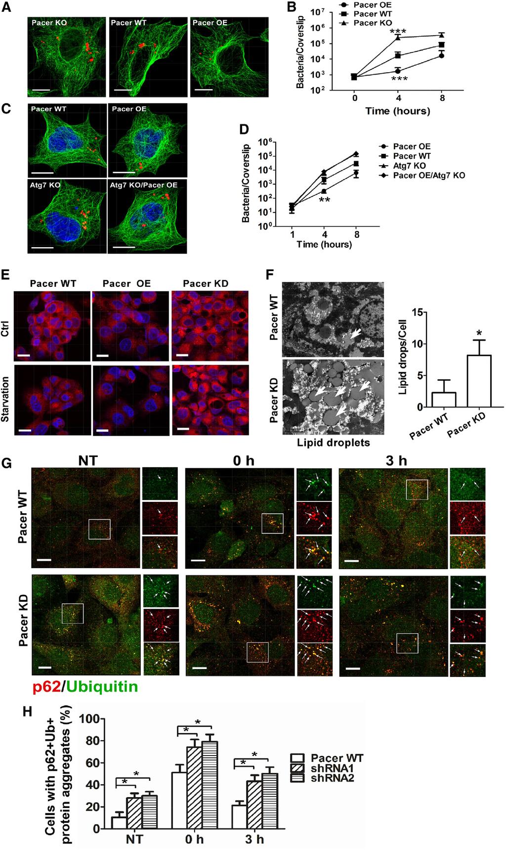 Figure 7. Pacer Regulates Bacterial Infection, Lipid Hemostatsis, and Protein Aggregate Clearance (A) Pacer is indispensable for autophagy-mediated suppression of bacterial replication in vivo.