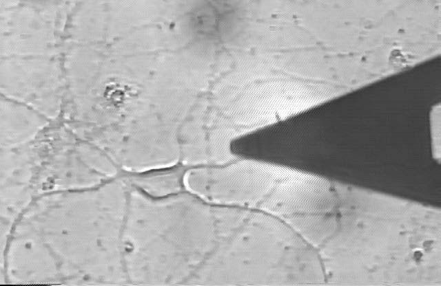 Electro-Mechanical Properties of Neuron Synapses Determine