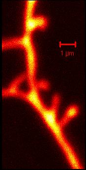 (reverse engineer Nature) axon spine dendrite AFM images