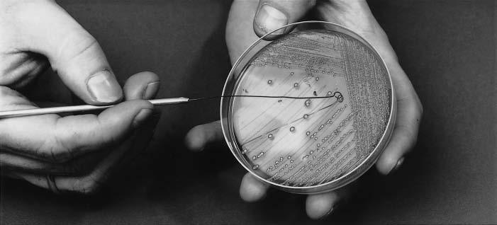 BACTERIOLOGICAL INVESTIGATIONS To ensure that the zone diameters are sufficiently reliable for testing susceptibility to sulfonamides and co-trimoxazole, the Mueller Hinton agar must have low