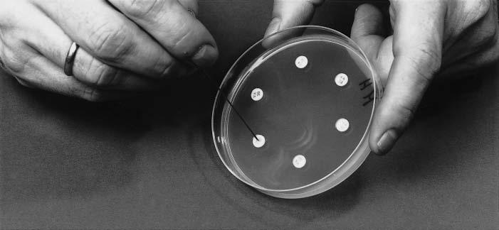 ANTIMICROBIAL SUSCEPTIBILITY TESTING Alternatively, an antimicrobial disc dispenser can be used to apply the discs to the inoculated plate. A maximum of seven discs can be placed on a 9 10cm plate.